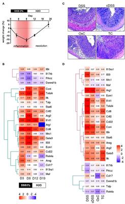 Comparative Transcriptomics of IBD Patients Indicates Induction of Type 2 Immunity Irrespective of the Disease Ideotype